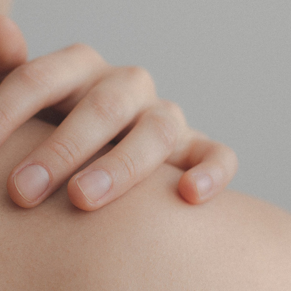 Essential oils for allergy and hives