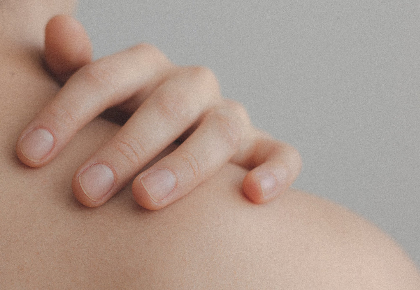 Essential oils for allergy and hives